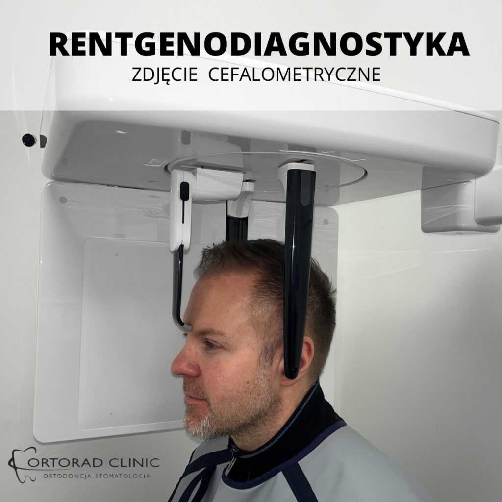 RTG cefalometryczne